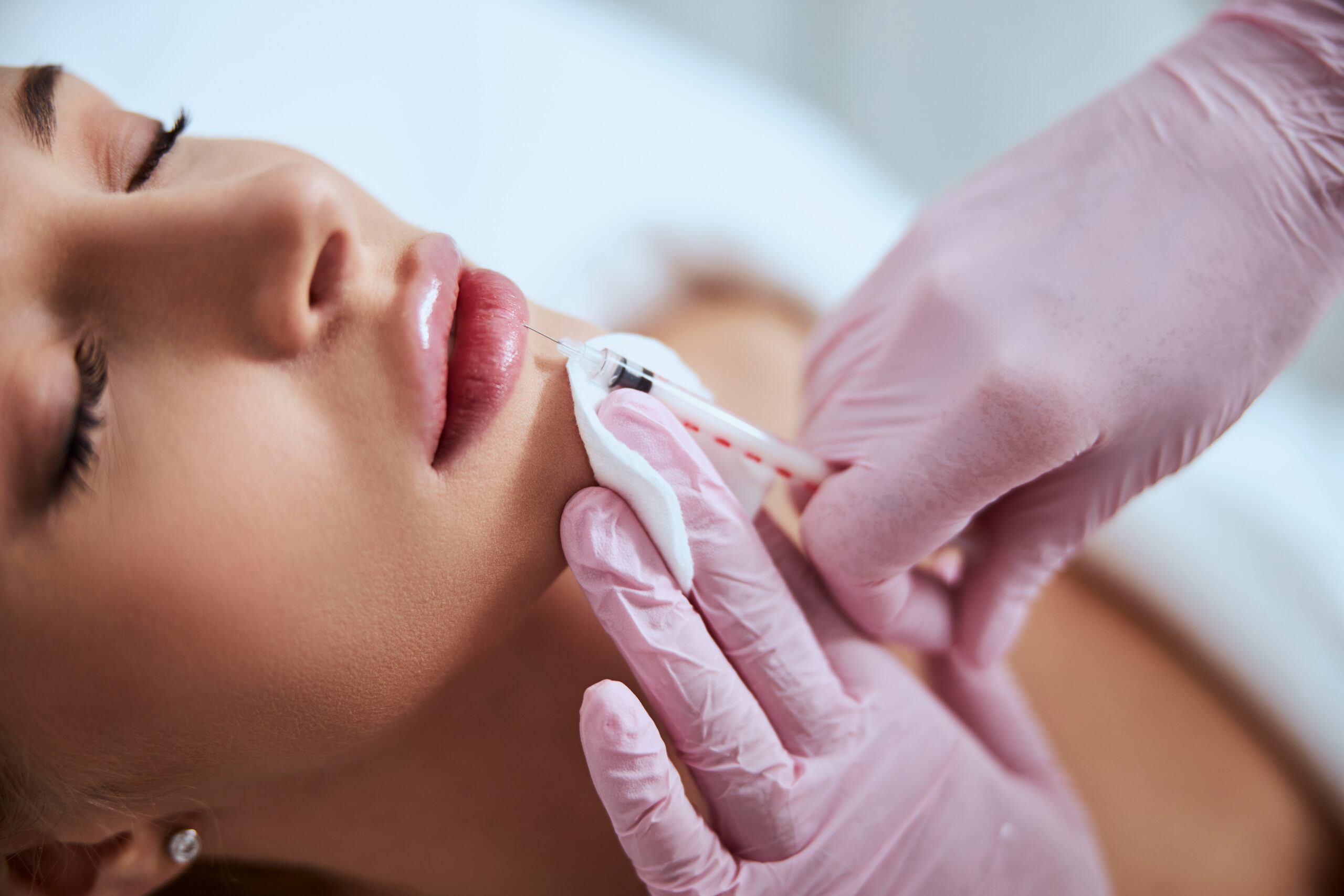 cosmetic lip augmentation close-up